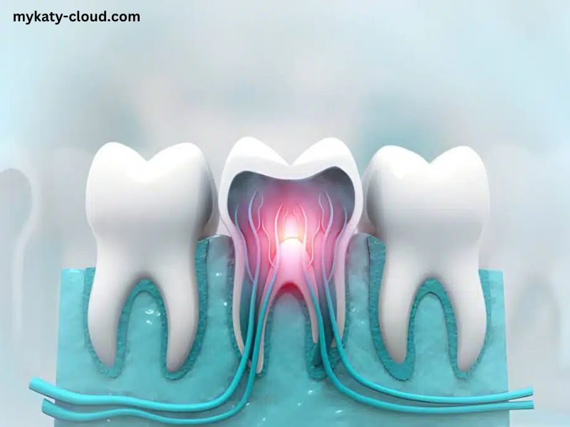 Kill Tooth Pain Nerve in 3 Seconds Permanently